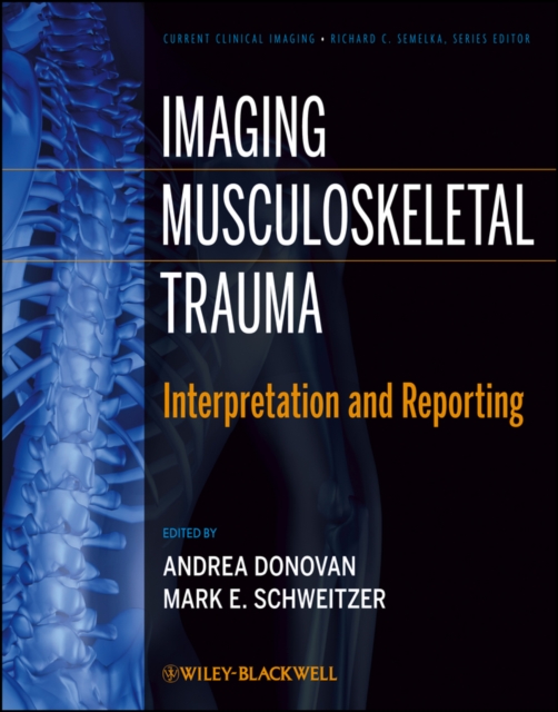 Imaging Musculoskeletal Trauma : Interpretation and Reporting, PDF eBook