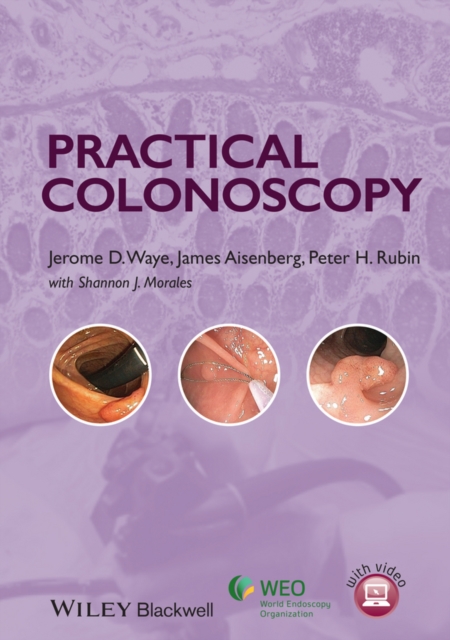 Practical Colonoscopy, EPUB eBook