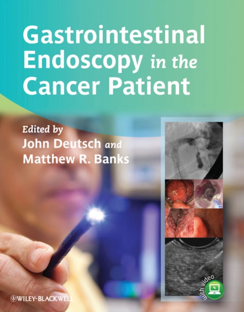 Gastrointestinal Endoscopy in the Cancer Patient, EPUB eBook