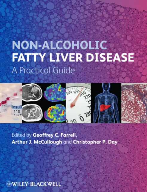 Non-Alcoholic Fatty Liver Disease : A Practical Guide, PDF eBook