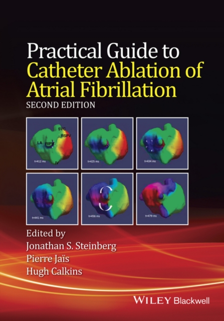 Practical Guide to Catheter Ablation of Atrial Fibrillation, EPUB eBook