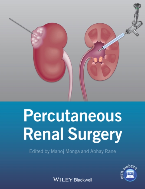 Percutaneous Renal Surgery, EPUB eBook