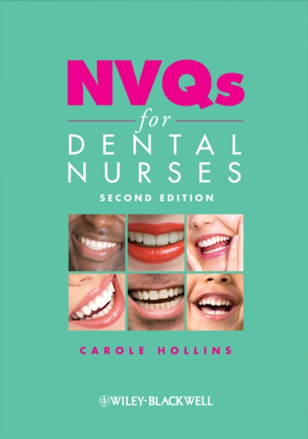 NVQs for Dental Nurses, EPUB eBook