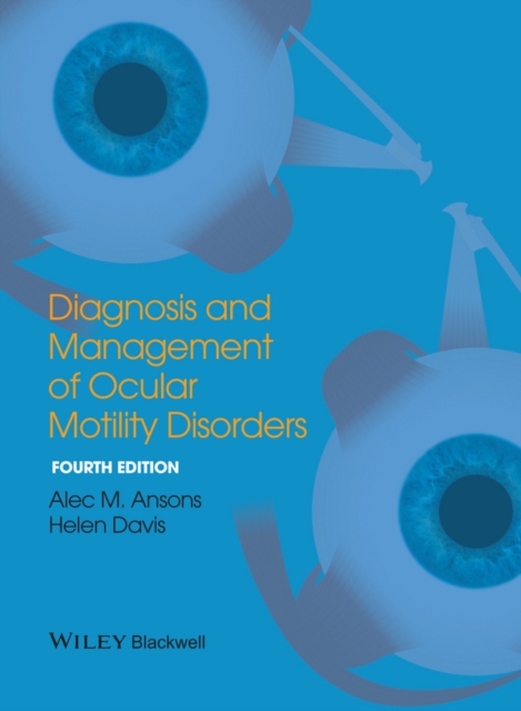 Diagnosis and Management of Ocular Motility Disorders, EPUB eBook