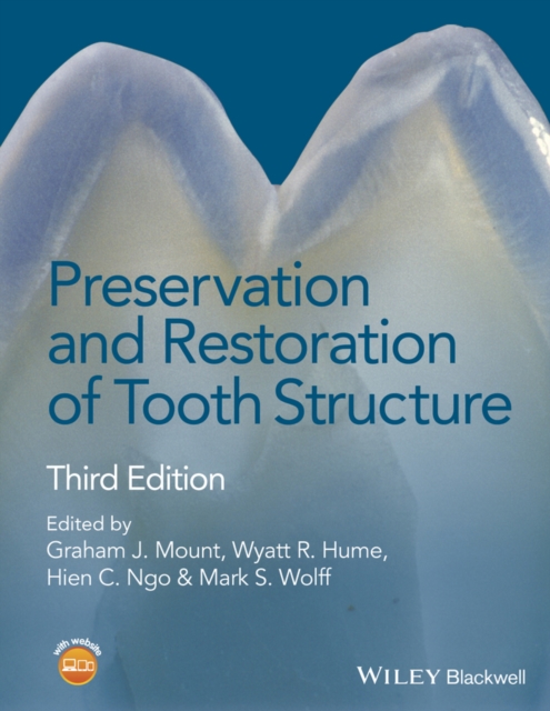 Preservation and Restoration of Tooth Structure, Hardback Book