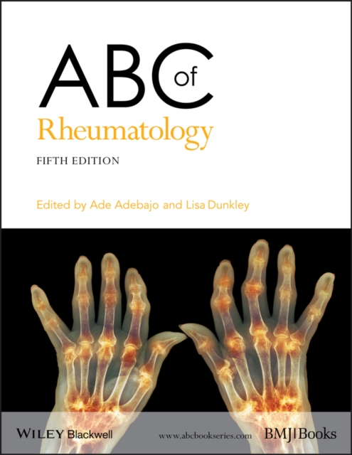 ABC of Rheumatology, EPUB eBook