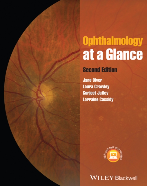 Ophthalmology at a Glance, PDF eBook