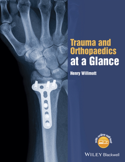 Trauma and Orthopaedics at a Glance, PDF eBook