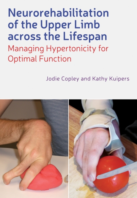 Neurorehabilitation of the Upper Limb Across the Lifespan : Managing Hypertonicity for Optimal Function, EPUB eBook