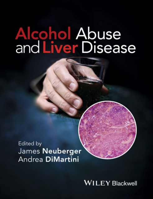 Alcohol Abuse and Liver Disease, EPUB eBook