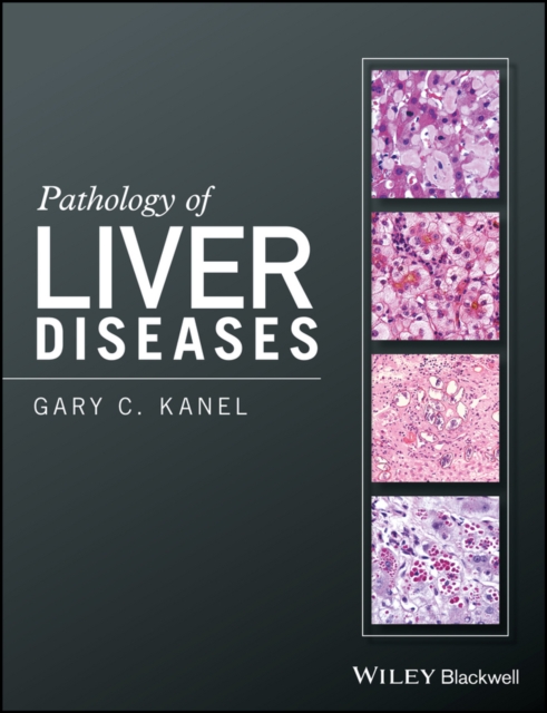 Pathology of Liver Diseases, EPUB eBook
