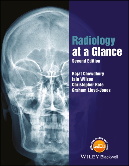 Radiology at a Glance, EPUB eBook