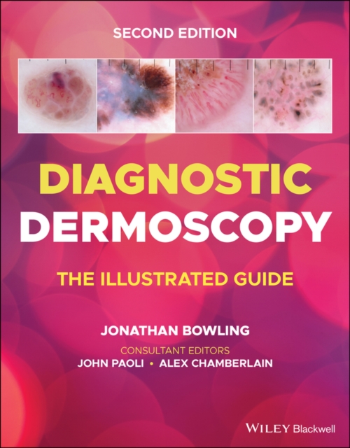 Diagnostic Dermoscopy : The Illustrated Guide, EPUB eBook