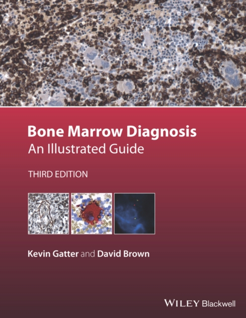 Bone Marrow Diagnosis : An Illustrated Guide, EPUB eBook