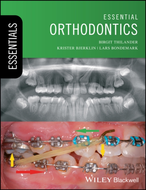 Essential Orthodontics, PDF eBook
