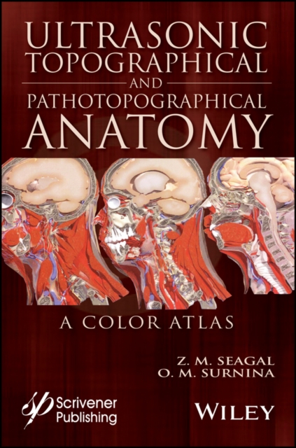 Ultrasonic Topographical and Pathotopographical Anatomy : A Color Atlas, PDF eBook