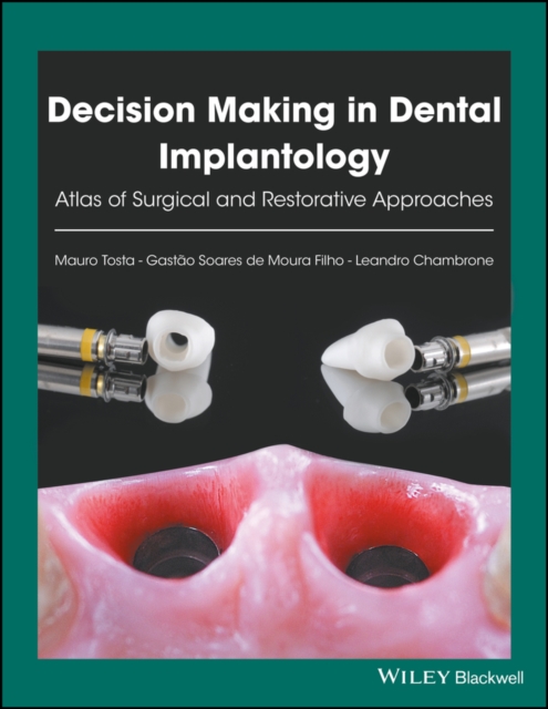 Decision Making in Dental Implantology : Atlas of Surgical and Restorative Approaches, EPUB eBook