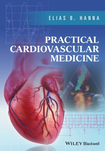 Practical Cardiovascular Medicine, PDF eBook