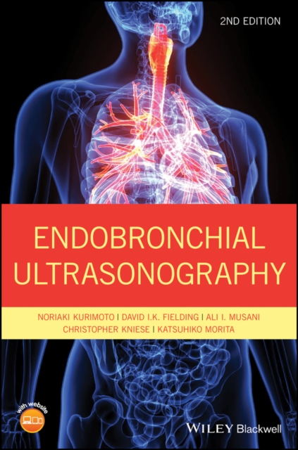 Endobronchial Ultrasonography, EPUB eBook