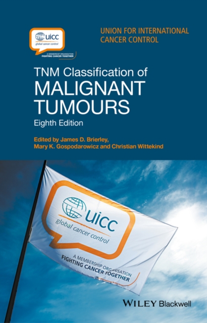 TNM Classification of Malignant Tumours, Paperback / softback Book