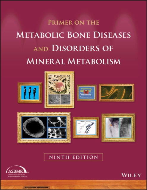 Primer on the Metabolic Bone Diseases and Disorders of Mineral Metabolism, EPUB eBook