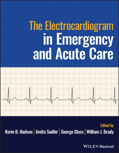 The Electrocardiogram in Emergency and Acute Care, Paperback / softback Book