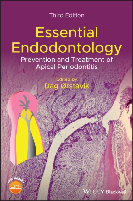 Essential Endodontology : Prevention and Treatment of Apical Periodontitis, Hardback Book