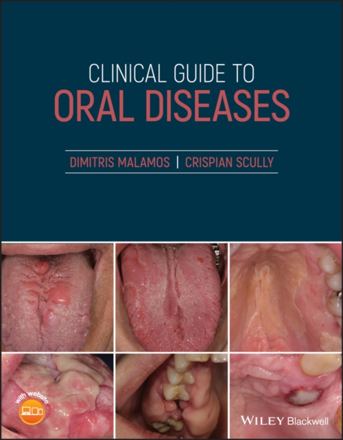 Clinical Guide to Oral Diseases, Paperback / softback Book