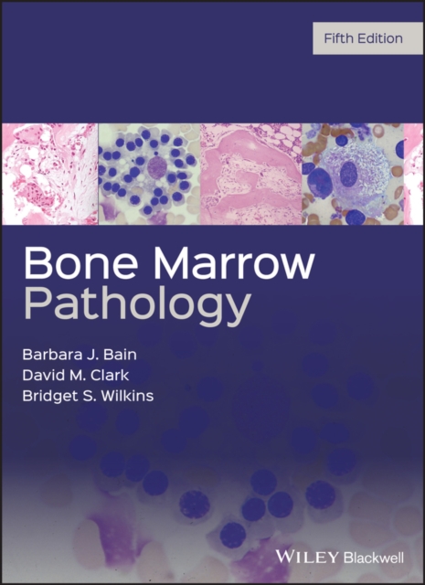Bone Marrow Pathology, EPUB eBook