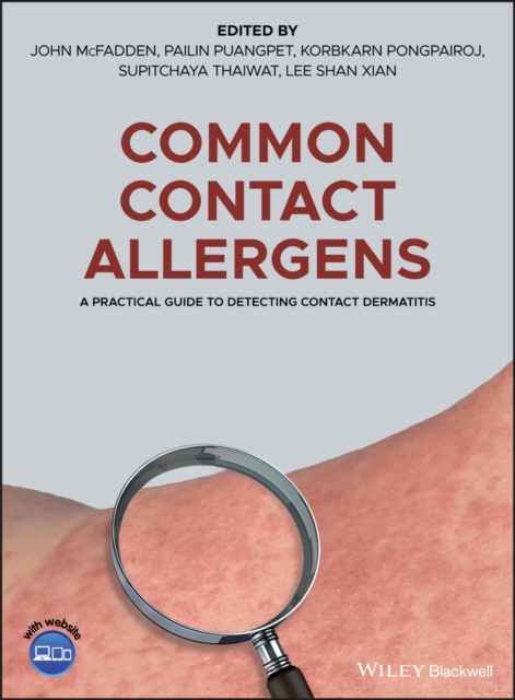 Common Contact Allergens : A Practical Guide to Detecting Contact Dermatitis, PDF eBook