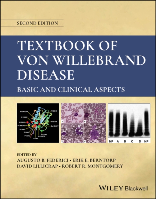 Textbook of Von Willebrand Disease : Basic and Clinical Aspects, Hardback Book