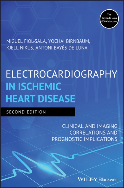 Electrocardiography in Ischemic Heart Disease : Clinical and Imaging Correlations and Prognostic Implications, PDF eBook
