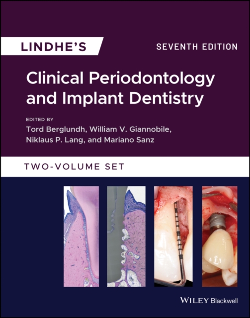 Lindhe's Clinical Periodontology and Implant Dentistry, EPUB eBook