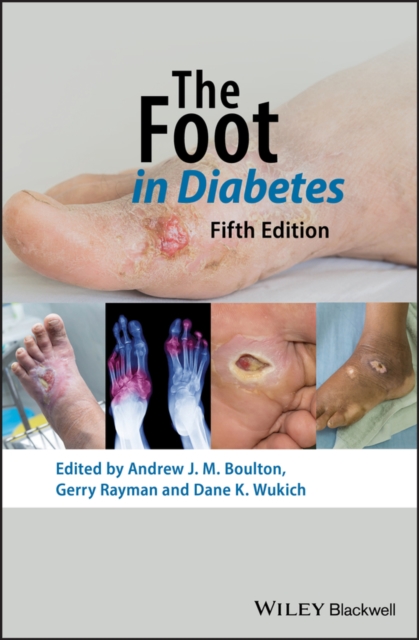 The Foot in Diabetes, EPUB eBook