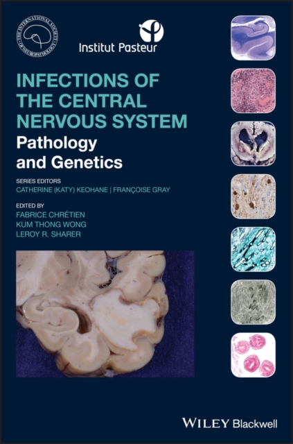 Infections of the Central Nervous System : Pathology and Genetics, EPUB eBook