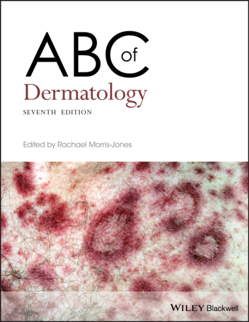 ABC of Dermatology, EPUB eBook
