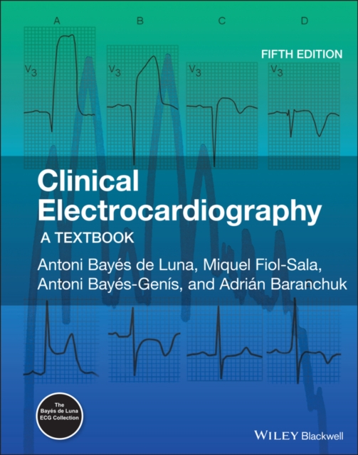 Clinical Electrocardiography : A Textbook, EPUB eBook