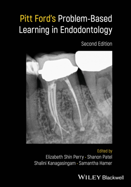 Pitt Ford's Problem-Based Learning in Endodontology, EPUB eBook