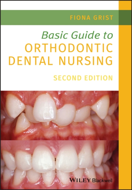 Basic Guide to Orthodontic Dental Nursing, Paperback / softback Book