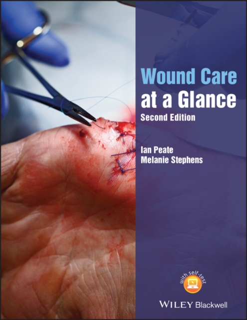 Wound Care at a Glance, PDF eBook