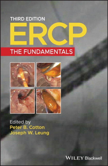 ERCP : The Fundamentals, PDF eBook