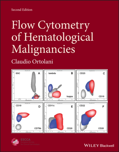 Flow Cytometry of Hematological Malignancies, Hardback Book