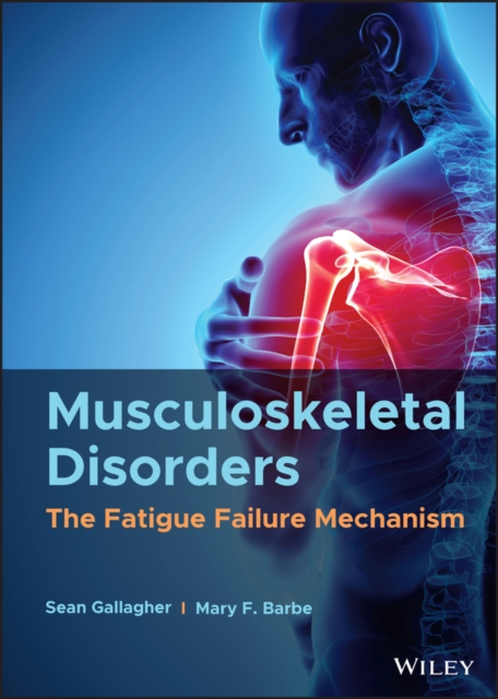 Musculoskeletal Disorders : The Fatigue Failure Mechanism, PDF eBook