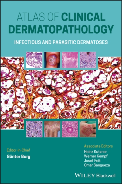 Atlas of Clinical Dermatopathology : Infectious and Parasitic Dermatoses, PDF eBook