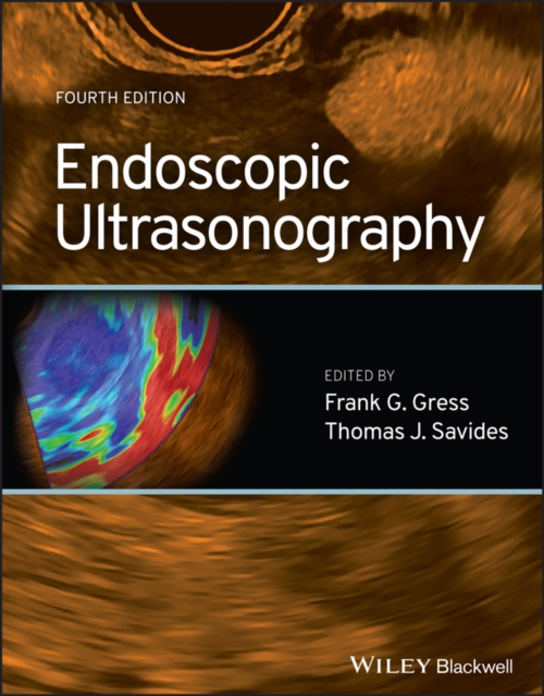 Endoscopic Ultrasonography, Hardback Book