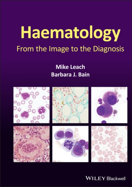Haematology : From the Image to the Diagnosis, Hardback Book