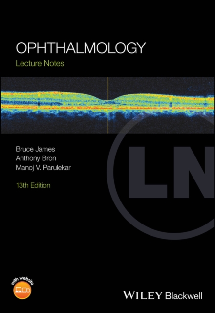 Ophthalmology : Lecture Notes, Paperback / softback Book