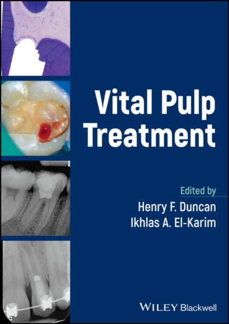 Vital Pulp Treatment, PDF eBook