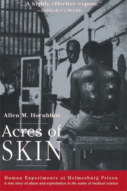 Acres of Skin : Human Experiments at Holmesburg Prison, EPUB eBook