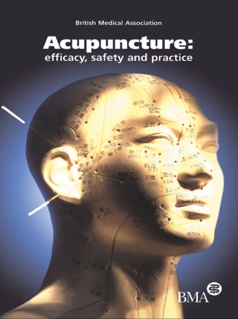 Acupuncture: Efficacy, Safety and Practice : Efficacy, Safety and Practice, EPUB eBook